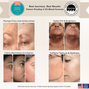 100% Organic Revitalizing Face Oil - Finally All Natural