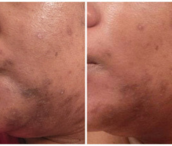 I feel beautiful without makeup and confident bare! Love love love!!!