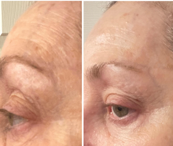 I am so SURPRISED that my skin is glowing for the first time in years!