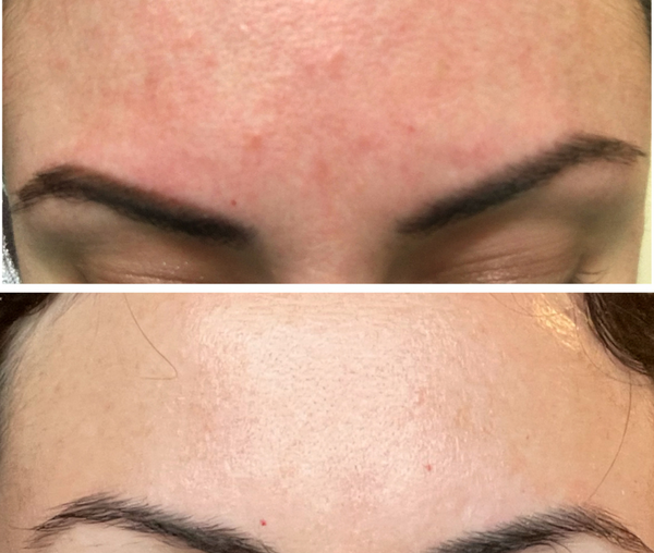 AMAZED! I've tried so many products, this is the first one to actually work.