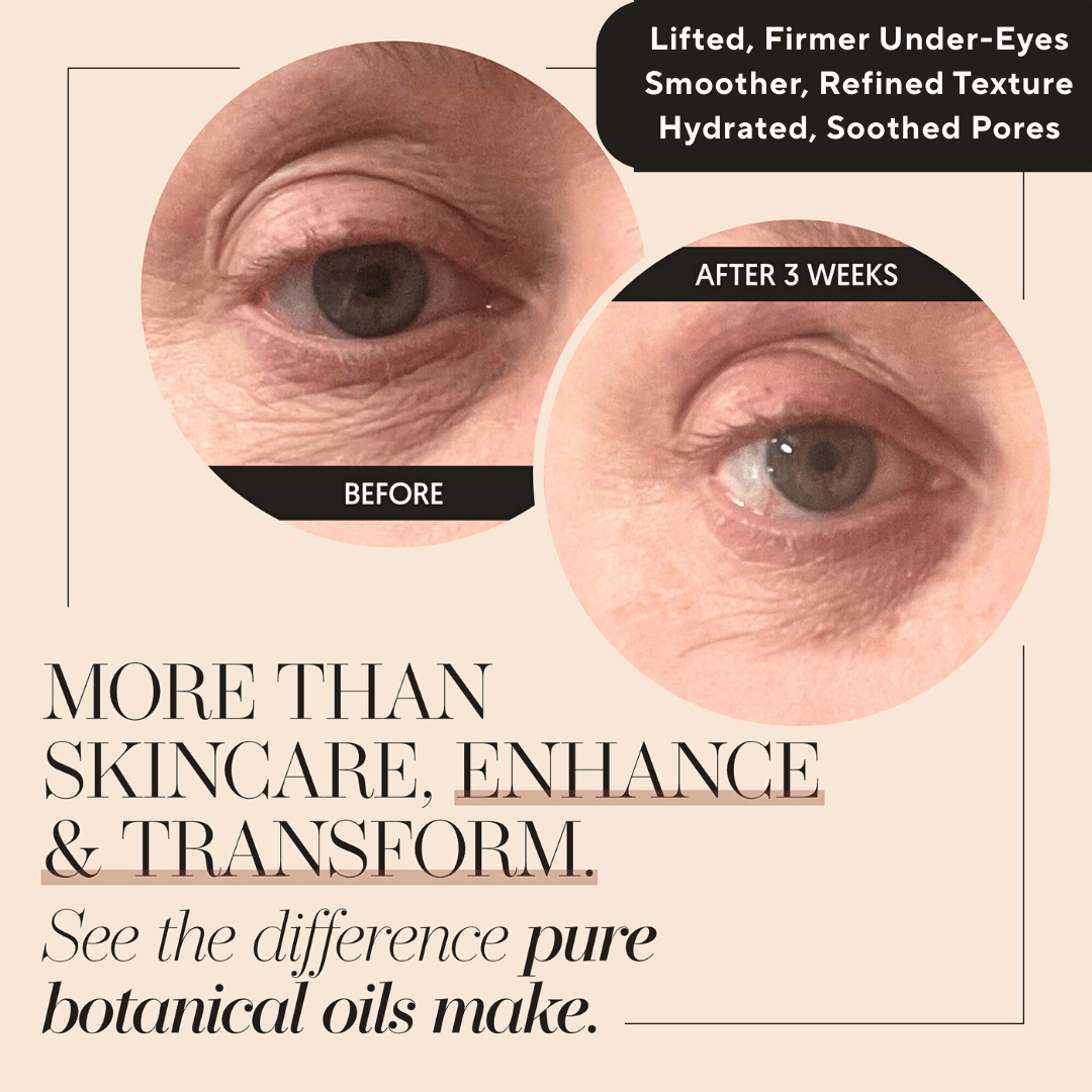 Face oil that works for wrinkles. Organic calendula