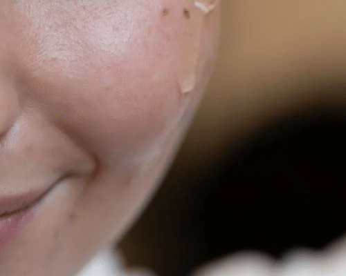 How to Naturally Remove Dark Spots from Your Face - Finally All Natural