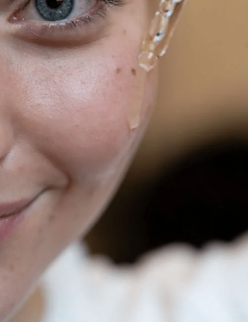 How to Naturally Remove Dark Spots from Your Face - Finally All Natural