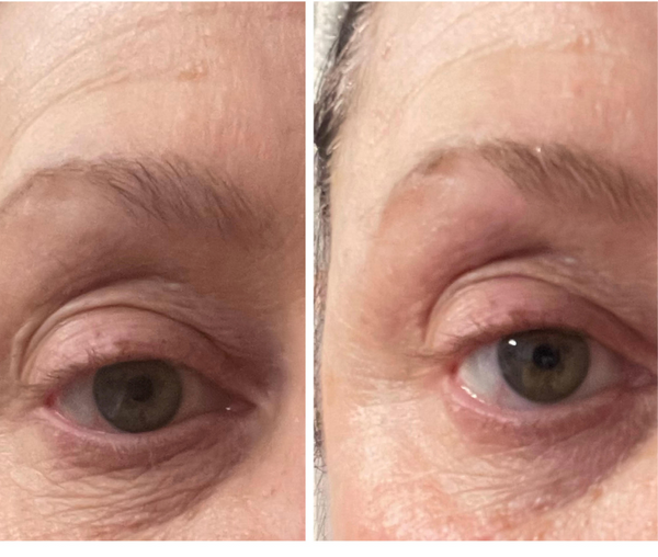 I switched from Estee Lauder eye cream and so glad I did. Love!