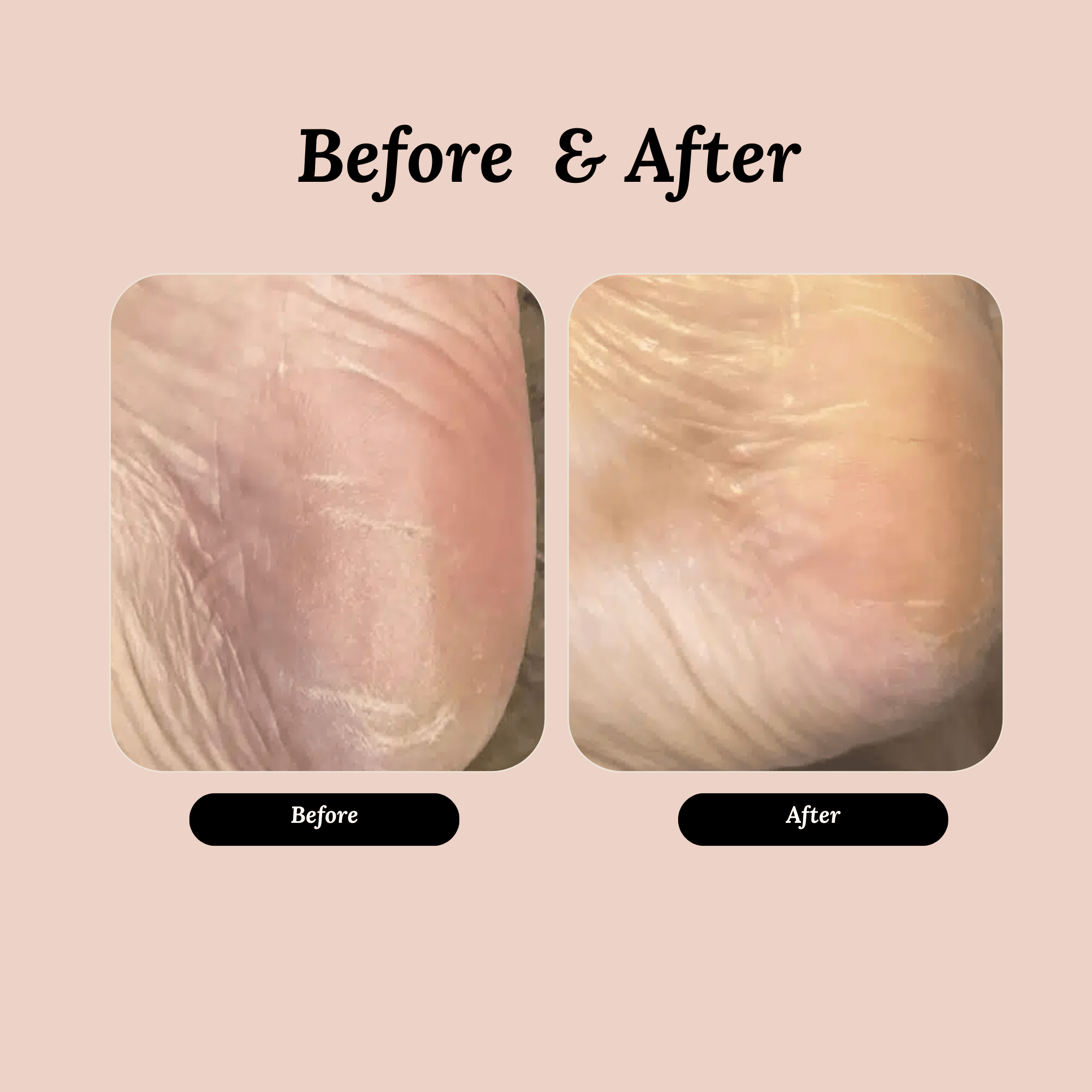 Ultra Hydration Blend Body Oil - My Store