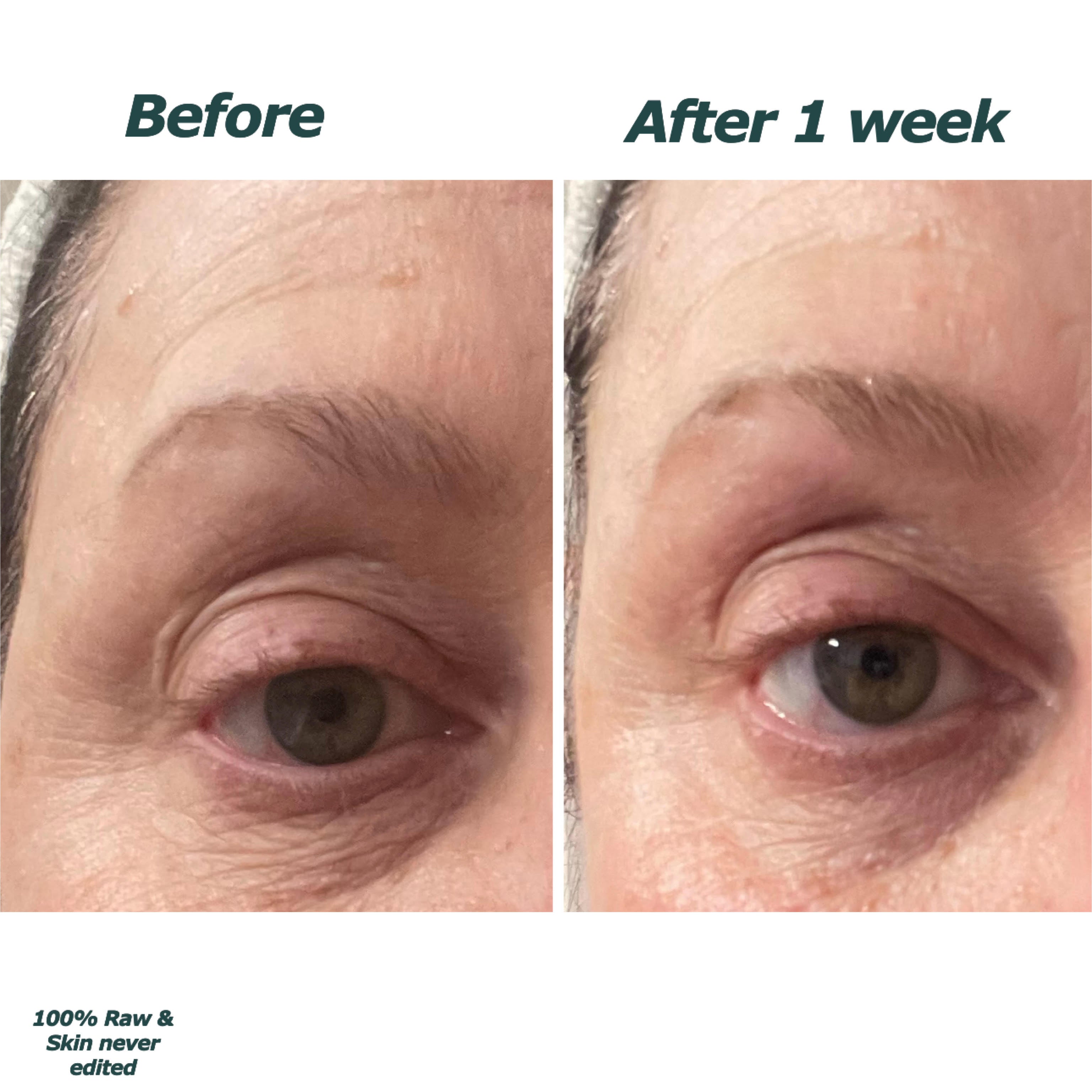 undereye.jpg